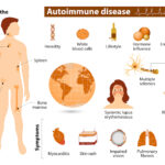 Bệnh tự miễn có chữa khỏi được không?
