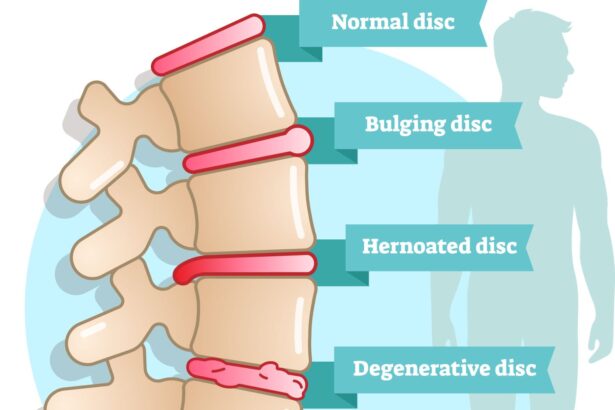 Kinh nghiệm tối ưu điều trị đau thắt lưng, đau cổ vai gáy, hội chứng ống cổ tay, thoái hóa khớp gối, thoái hóa cột sống
