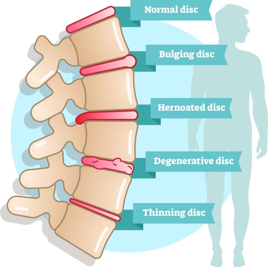 Kinh nghiệm tối ưu điều trị đau thắt lưng, đau cổ vai gáy, hội chứng ống cổ tay, thoái hóa khớp gối, thoái hóa cột sống